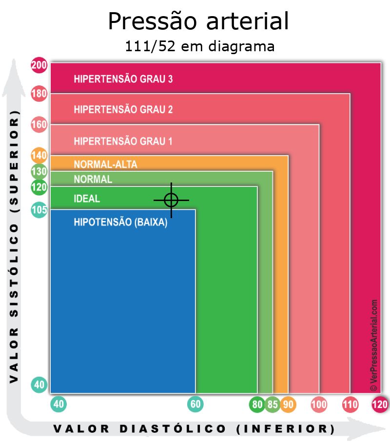 Pressão arterial 111 por 52 em diagrama