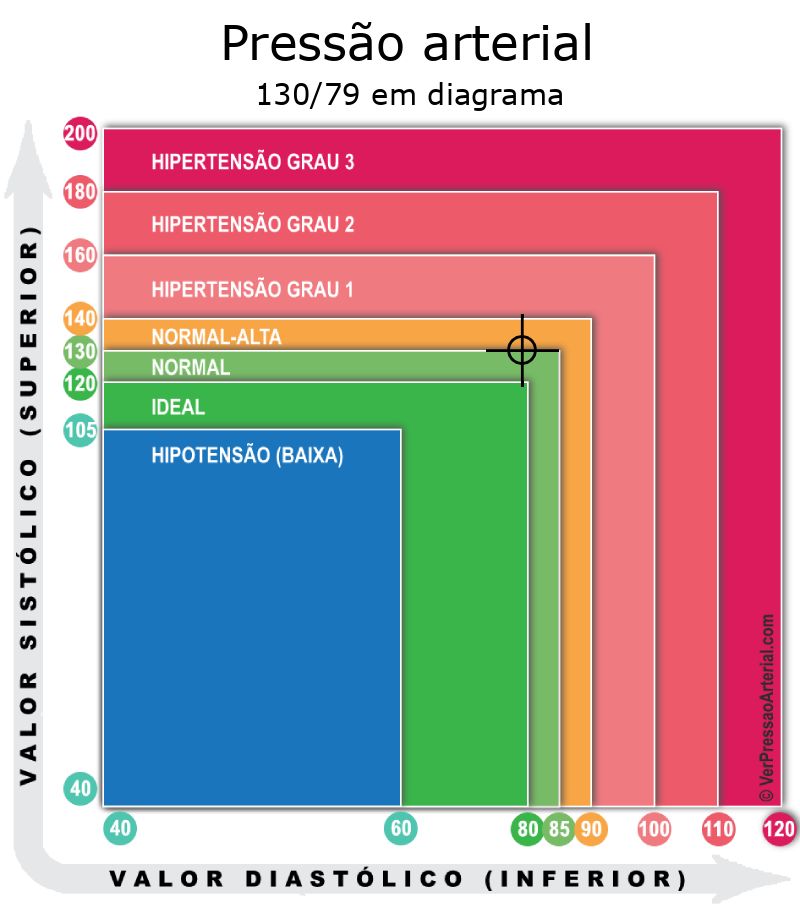 Pressão arterial 130 por 79 em diagrama