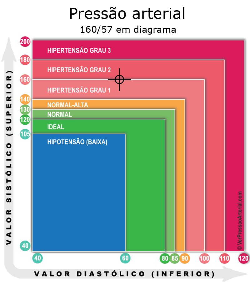 Pressão arterial 160 por 57 em diagrama