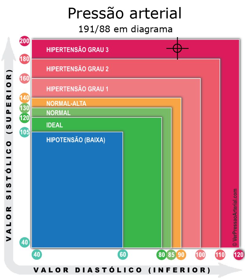 Pressão arterial 191 por 88 em diagrama