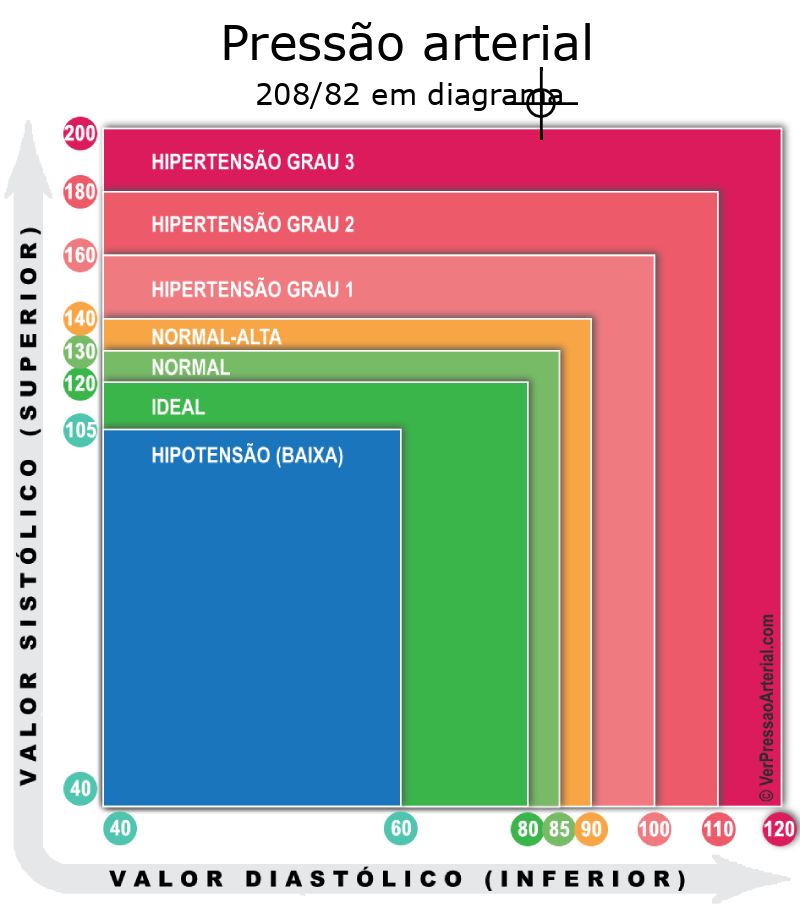 Pressão arterial 208 por 82 em diagrama
